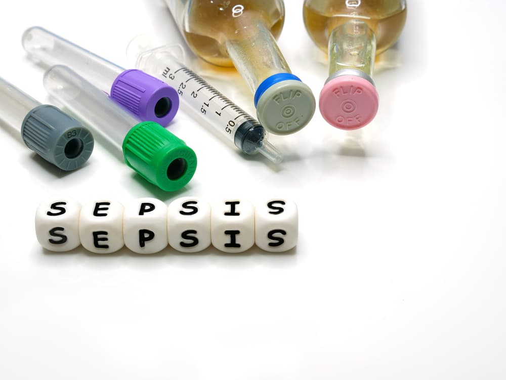 sepsis