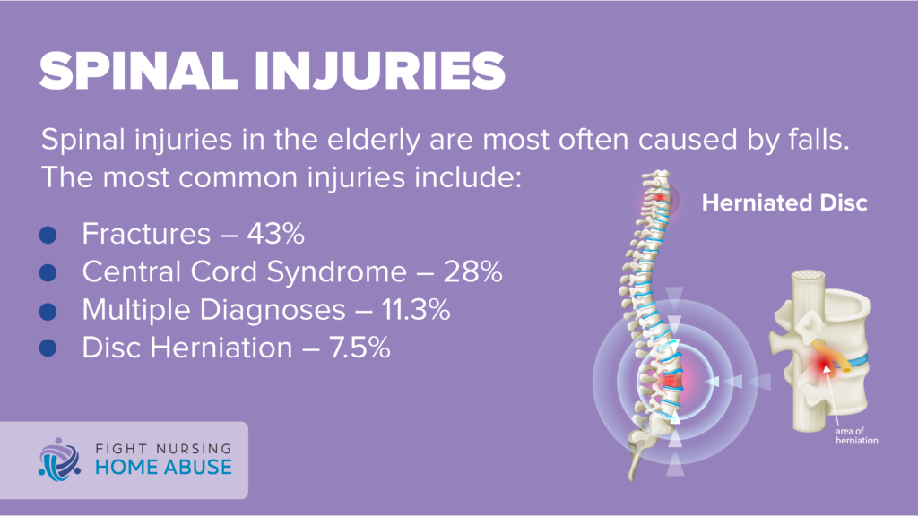 spinal injuries